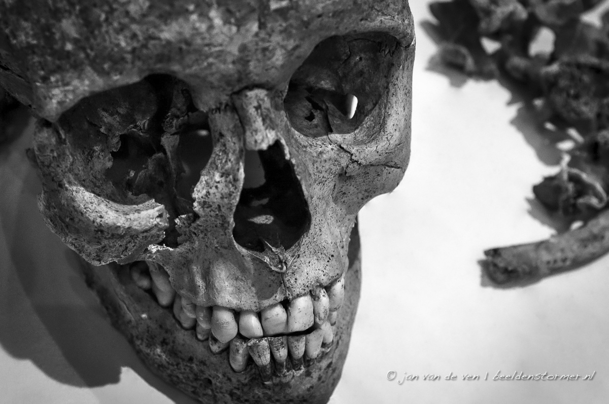 de schedel van een franse soldaat uit het massagraf op bastion baselaar